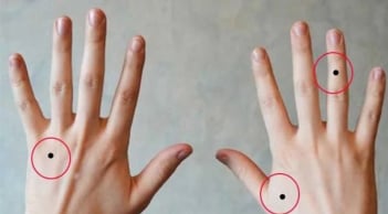 Chỉ cần có nốt ruồi này: Cả đời hưởng phú quý, may mắn không ngừng