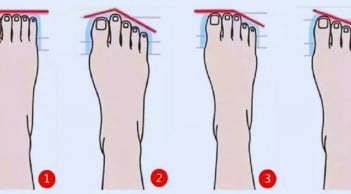 Xem hình dáng bàn chân, biết rõ tính cách tiềm ẩn của bạn