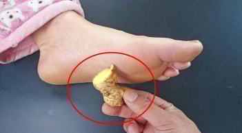 4 lợi ích tuyệt vời khi đắp gừng vào lòng bàn chân vào buổi tối