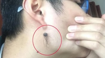 Mọc lông ở 4 vị trí này trên cơ thể càng nhiều thì càng phát tài, phú quý tìm đến, tài lộc đồi dào