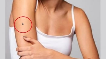 5 vị trí nốt ruồi 'xấu thậm tệ', phá đường công danh, tình duyên bạn cần tẩy gấp