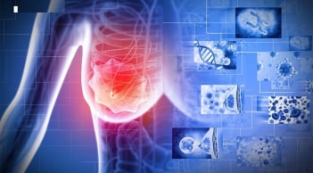 “3 đen” xuất hiện trên cơ thể báo hiệu bệnh K rất gần, gặp bác sĩ ngay