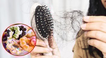 5 thực phẩm càng ăn càng gây rụng tóc, món số 1 nhiều người thích