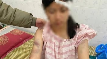 Bà nội cùng hai người đàn ông tra khảo, đánh đập cháu gái 13 tuổi dã man - Lý do gây phẫn nộ