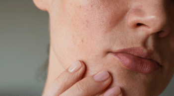 Làm thế nào để hạn chế khô da vào mùa đông?