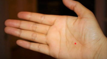 5 nốt ruồi son mang lại vận đỏ như son cho bạn