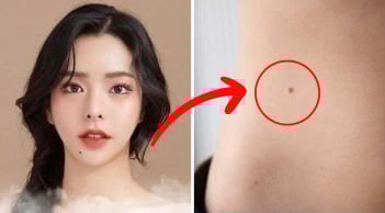 Phụ nữ có 3 nốt ruồi ở vị trí hiếm này: Số mệnh phú quý, viên mãn, tình tiền sáng rực rỡ