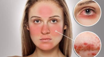 Những nguyên nhân phổ biến lý giải vì sao làn da ngày càng trở nên 'khó chiều'