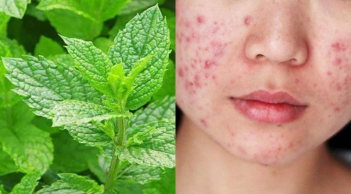 5 mẹo làm đẹp da và tóc với bạc hà