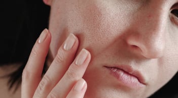 Những sai lầm phổ biến khi chăm sóc da mùa đông