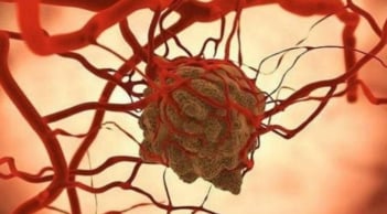 Tế bào ung thư sợ nhất điều gì? Chuyên gia chỉ ra loạt “điểm yếu chí mạng” ngăn chặn và tiêu diệt ung thư