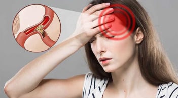 5 nguy cơ của bệnh thiếu máu não và cách phòng ngừa