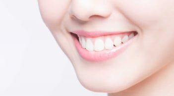 Tẩy trắng răng tại nhà: Cách cải thiện màu răng an toàn cho men răng nhạy cảm