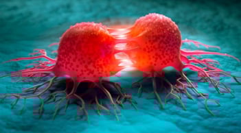 3 dấu hiệu vào buổi tối của người dễ mắc ung thư