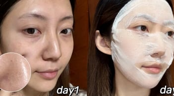 Blogger 28 tuổi dưỡng trắng da, mờ thâm nám nhờ routine khoa học tại nhà