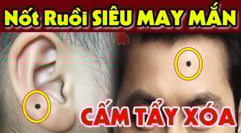 5 nốt ruồi Ông Bà cho Phúc, đời này chỉ lo ăn no ngủ kỹ