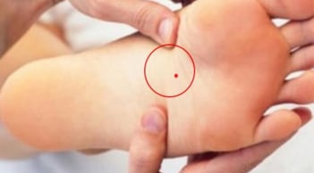 4 nốt ruồi ở chỗ kín hút tài lộc: Đừng dại xóa đi