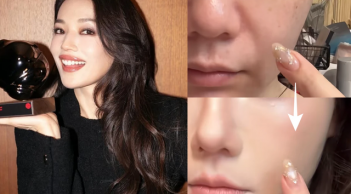 Bí quyết che rãnh cười giúp Thư Kỳ giữ vẻ trẻ trung ở tuổi 50 khiến cộng đồng làm đẹp chú ý