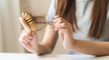4 vấn đề da đầu âm thầm khiến tóc rụng nhiều hơn và cách xử lý đúng cách