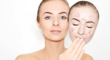 Giải cứu làn da xuống sắc sau Tết: Phục hồi đúng cách để da khỏe lại từ gốc