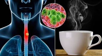 Cảnh báo: Loại nước nhiều người Việt uống mỗi ngày có thể làm tăng gấp 6 lần nguy cơ ung thư