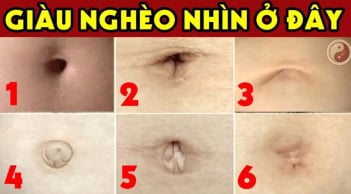 Nhìn tướng rốn biết tương lai bạn giàu sang hay nghèo khổ