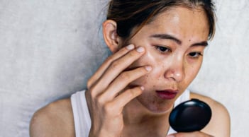 5 dấu hiệu cho thấy khí huyết của chị em đang bị suy yếu