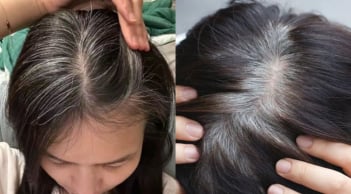 3 nhóm người dễ bị tóc bạc sớm, ngoài 30 tuổi tóc đã bạc trắng