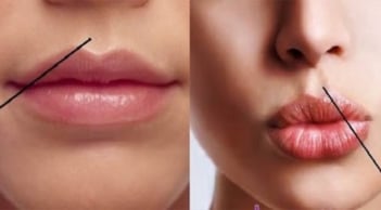 Nếu có 2 vị trí đủ sâu này có trong cơ thể con người, thì cơ hội trường thọ càng lớn