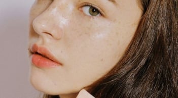 4 cách giảm đốm nâu tại nhà được bác sĩ da liễu khuyên áp dụng