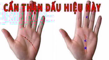 Bàn tay có 4 nét tướng này dù tài ba tới mấy cũng khó thoát nghèo