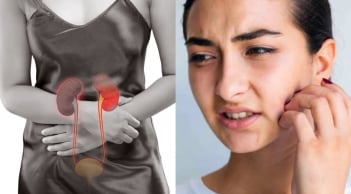 5 dấu hiệu trên mặt cảnh báo suy thận đang âm thầm xảy ra