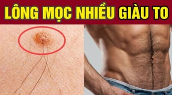 3 vị trí càng nhiều lông càng giàu có