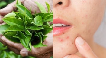 Trà xanh và làn da: lợi ích nổi bật cùng cách sử dụng đúng để hỗ trợ chống lão hóa