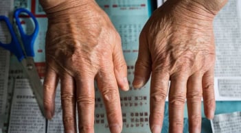 Bàn tay người sống thọ có đặc điểm gì? Nghiên cứu 2 triệu người chứng minh sự thật bất ngờ