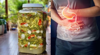 5 thực phẩm càng ăn nhiều càng dễ bị ung thư dạ dày