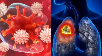 5 loại ung thư phổ biến và nguy hiểm nhất