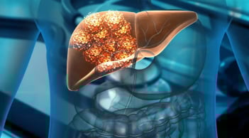 5 dấu hiệu vào ban đêm của người suy gan nặng