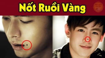 3 nốt ruồi may mắn: Ai có được đừng dại xóa đi