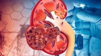 4 dấu hiệu người bị suy thận, buổi tối gặp 1/5 cũng dè chừng