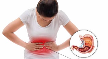 5 biểu hiện của bệnh dạ dày: Có 1 cũng nên đi khám sớm