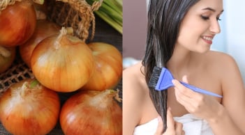 Nước ép hành tây có thực sự giúp mọc tóc? Cách dùng đúng để tránh kích ứng da đầu