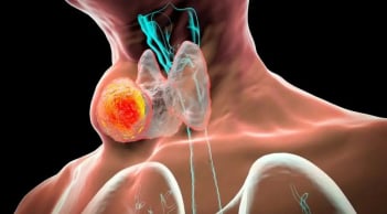 5 dấu hiệu ung thư tuyến giáp giai đoạn cuối: Đặc biệt dấu hiệu đầu tiên