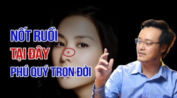 3 nốt ruồi may mắn giàu sang trọn đời
