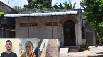 Hé lộ nhân thân mẹ ruột và người tình trong vụ bé trai 2 tuổi bị bạo hành gây phẫn nộ