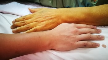5 dấu hiệu cảnh báo gan thận đang 'kêu cứu', số 1 bệnh đã chuyển nặng