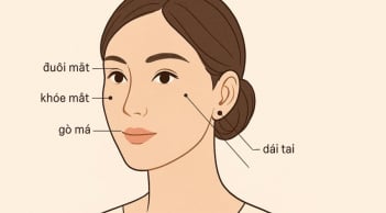 3 nốt ruồi trên mặt mang tới may mắn cho bạn: Cả đời bình an