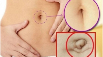 Nhìn tướng rốn 3 giây biết tương lai bạn giàu sang hay nghèo khổ