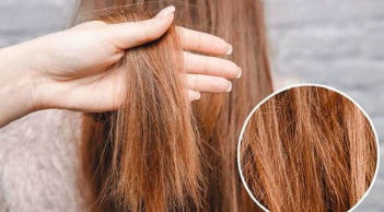 5 cách phục hồi tóc cháy nắng giúp tóc mềm hơn, giảm khô xơ trong mùa hè