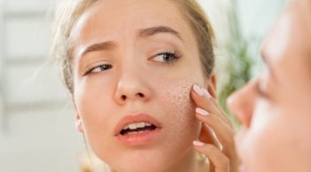 Dưỡng ẩm quá mức có thể khiến da “quá tải”